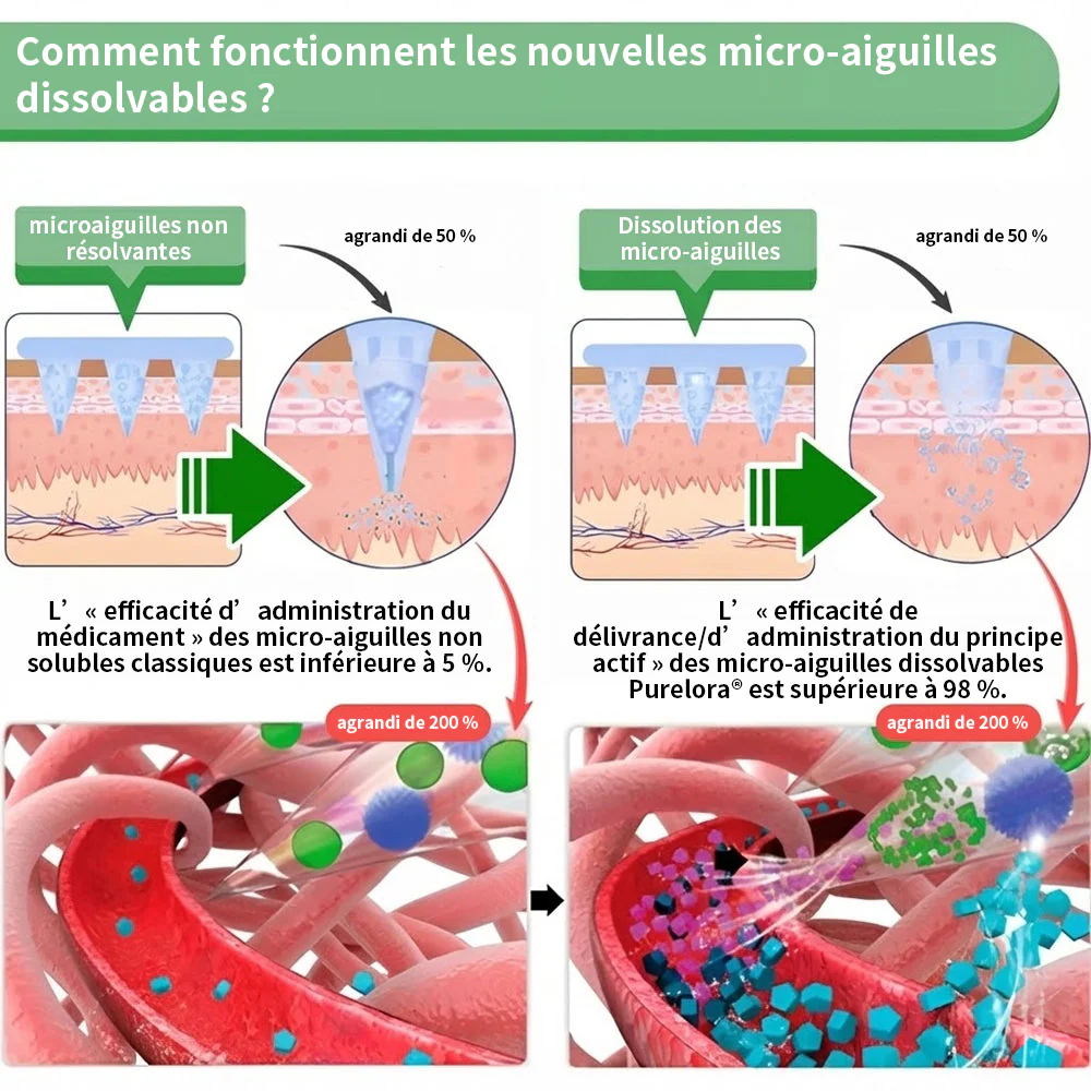 🏆 Recommandation n°1丨Purelora® Moringa Berbérine x NAD+ Patch Nano-Microneedle 10-en-1 Une application par jour, changements visibles dès 7 jours. Pour accompagner la gestion du poids, la fermeté de la peau et le bien-être global. - Image 5