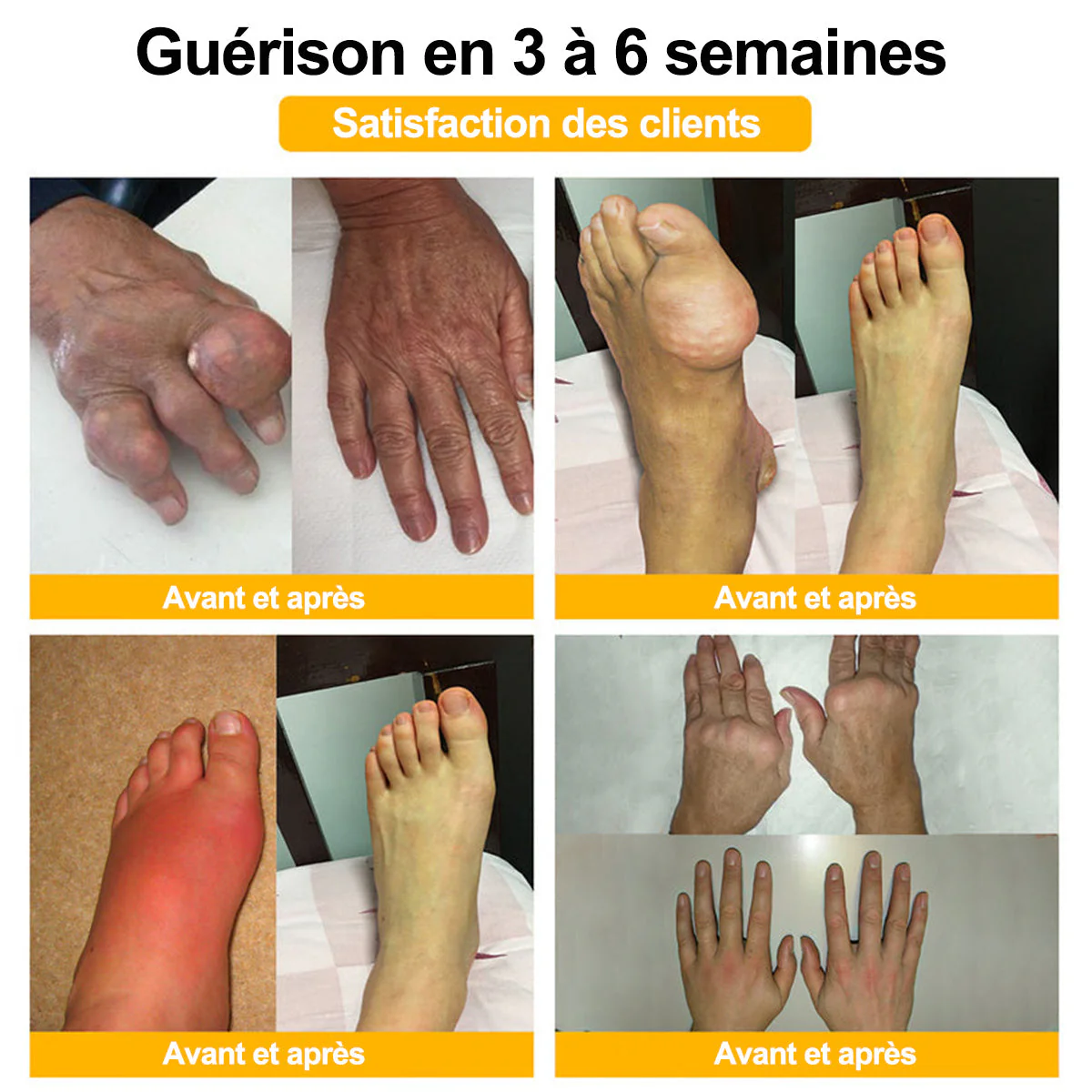 Purelora® Venin d'abeille Crème cicatrisante osseuse Pain-Relief 🐝🐝(Spécialement conçu pour les personnes âgées ) - Image 5