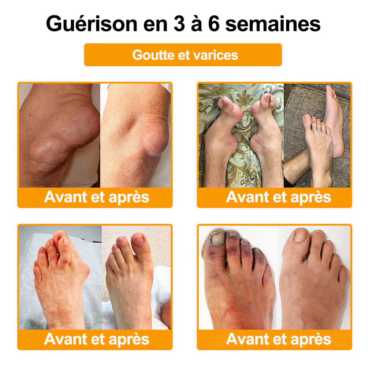 Purelora® Venin d'abeille Crème cicatrisante osseuse Pain-Relief 🐝🐝(Spécialement conçu pour les personnes âgées ) - Image 6
